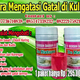 Illustration for article titled obat gatal kulit eksim keringem/em